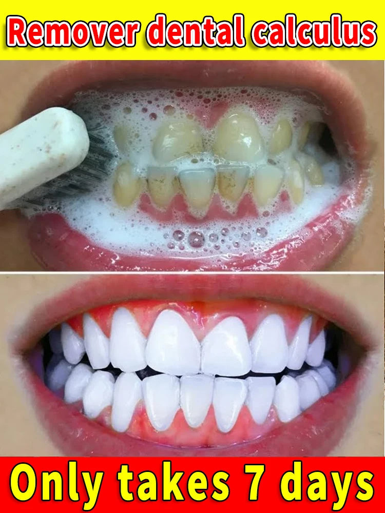 Toothpaste Whitening Tooth Remove  Stains