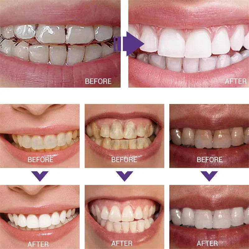 Teeth Cleansing Whitening Toothpaste