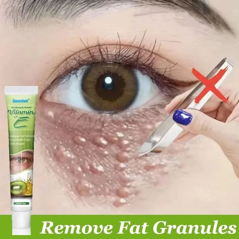 Fat Granules Remover Skin Care