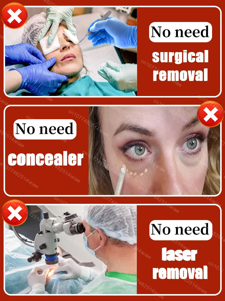 Instantly removes under eye bags,